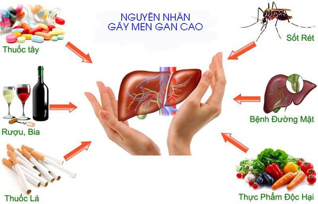 MEN GAN TĂNG CAO LÀ GÌ? 3 NGUYÊN NHÂN KHIẾN MEN GAN TĂNG CAO