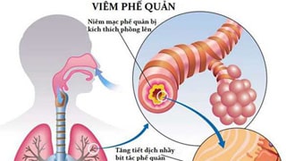 CƠN HO CỦA TRẺ EM? 2 CƠN HO CỦA TRẺ EM