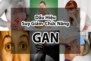 suy gan 2 1