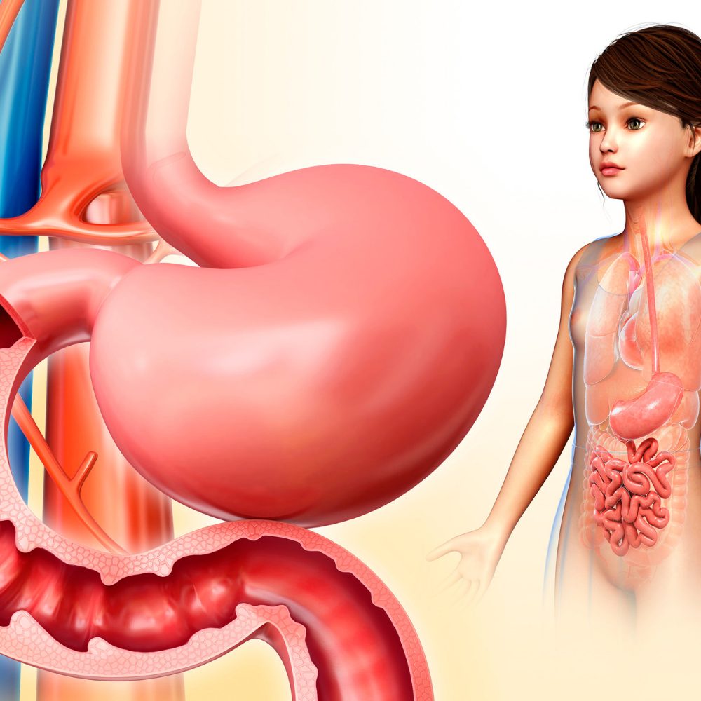 Cắt dạ dày có tiêu hóa được không? 2 Thiết kế không tên 14 3