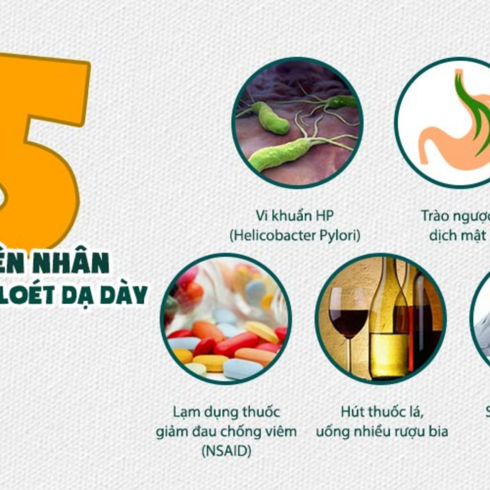 Đau dạ dày: Các triệu chứng và cách điều trị hiệu quả 2 Các nguyên nhân của bệnh đau dạ dày