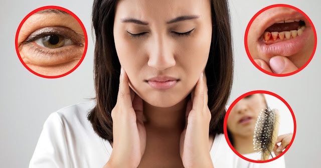 "Vitamin" có cần thiết với mỗi con người? 4 thieu vitamin 1494235299896