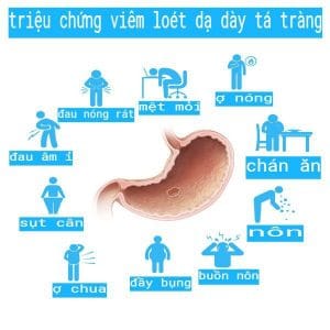 triệu chứng bệnh viêm loét dạ dày tá tràng