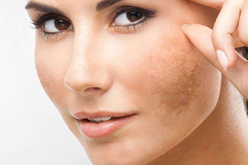 Con gái có bị yếu sinh lý không? 4 yslon