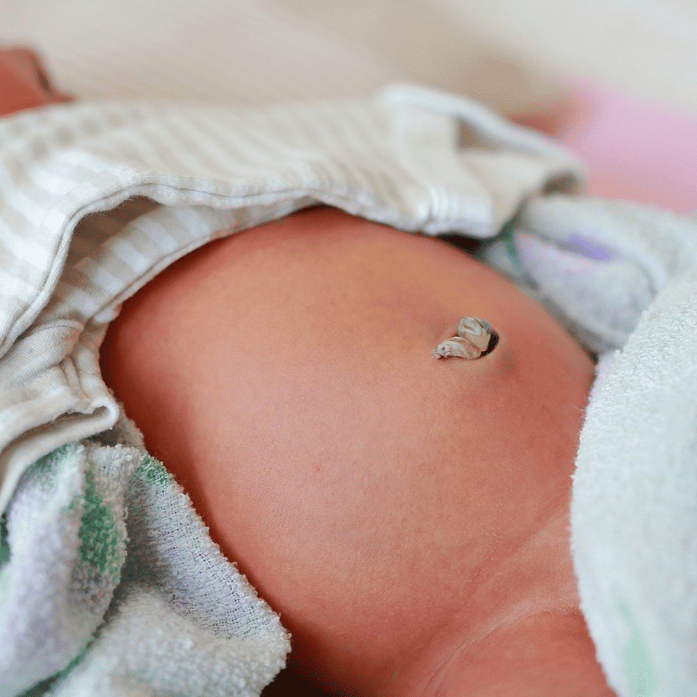 Cách chăm sóc rốn cho trẻ sơ sinh 3 Cách chăm sóc rốn cho trẻ sơ sinh