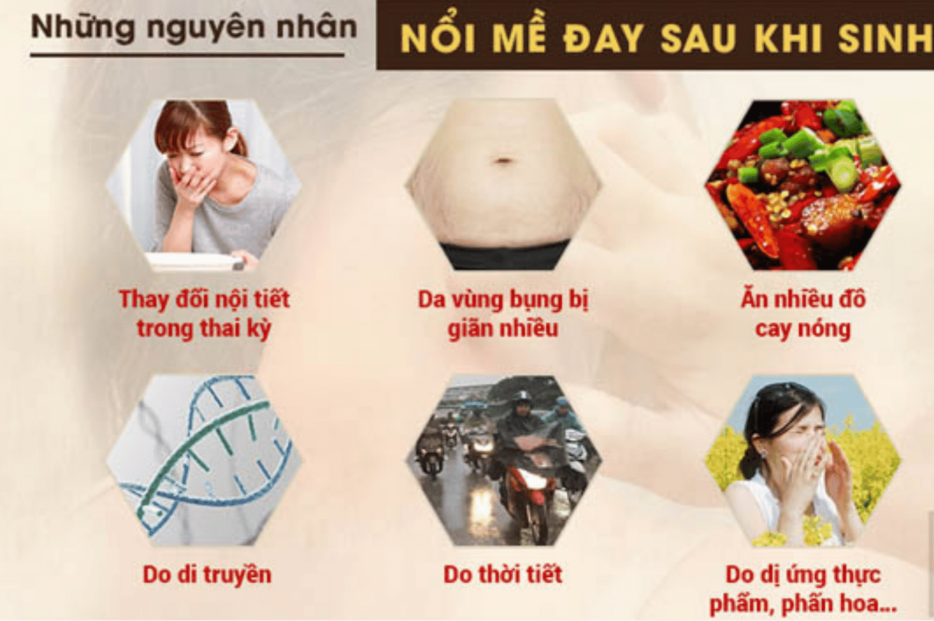 Nổi mề đay sau sinh 2 nổi mề đay sau sinh