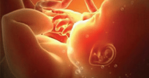 Dây rốn hai mạch máu