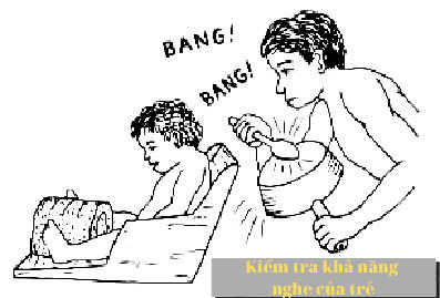 Bại não 4 bãi não