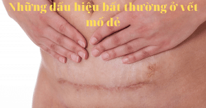 Những dấu hiệu bất thường ở vết mổ đẻ