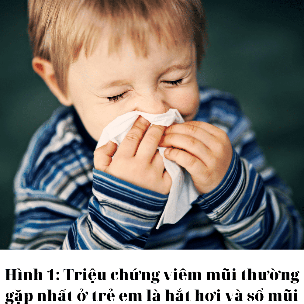 Viêm mũi ở trẻ em 1 viêm mũi