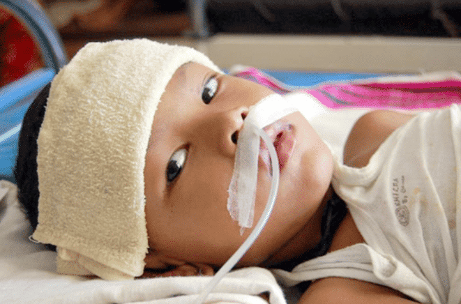 Viêm não Nhật Bản ở trẻ em 1 Viêm não Nhật Bản ở trẻ em