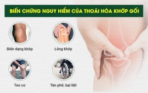 biến chứng nguy hiểm của bệnh thoái hóa khớp