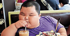 béo phì ở trẻ em