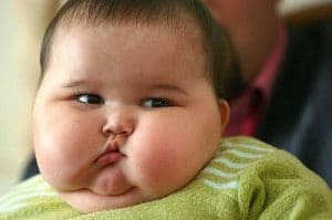 Tìm hiểu bệnh lý béo phì ở trẻ em 3 béo phì ở trẻ em