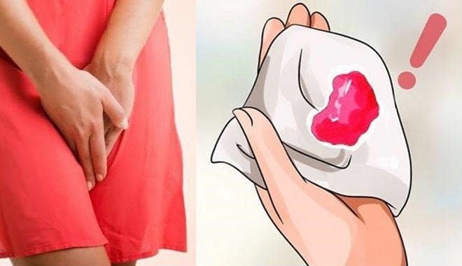 băng huyết sau sinh 