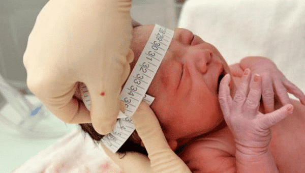 Giãn não thất ở thai nhi 1 giãn não thất ở thai nhi