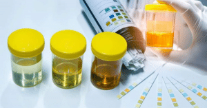 nhiễm trùng tiểu ở trẻ nhỏ