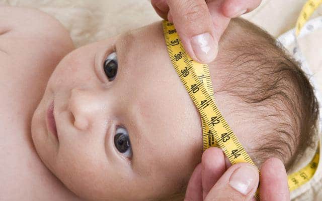 Nhận biết sớm dấu hiệu não úng thủy 1 não úng thủy