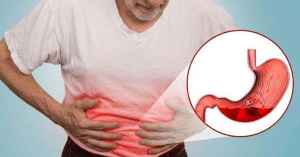 Các dấu hiệu cảnh báo xuất huyết dạ dày