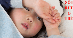 SỐT RÉT Ở TRE