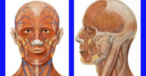 chấn thương hàm mặt