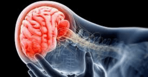 chấn thương sọ não