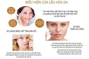LÃO HÓA " THỦ PHẠM GIẤU MẶT " CỦA CHỊ EM PHỤ NỮ 2 dấu hiệu quá trình lão hóa