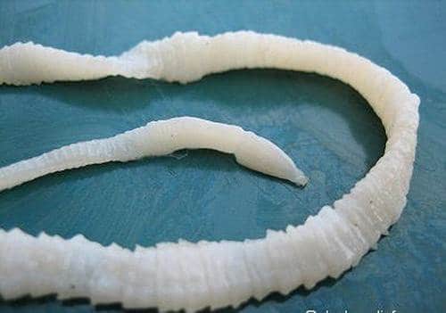Dấu hiệu khi cơ thể nhiễm ký sinh trùng 2 nhiễm ký sinh trùng