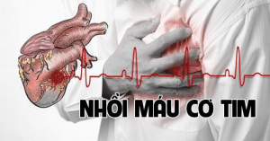 nhồi máu cơ tim