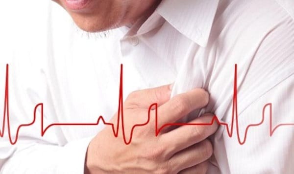 Bệnh nhồi máu cơ tim là gì? 2 nhồi máu cơ tim
