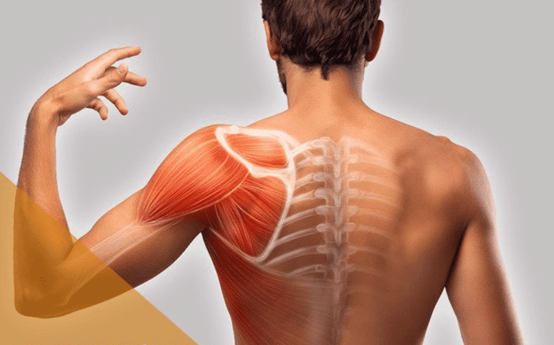 Viêm cơ là gì? 1 viêm cơ