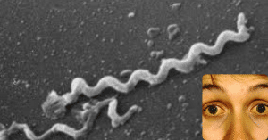 xoắn khuẩn vàng da