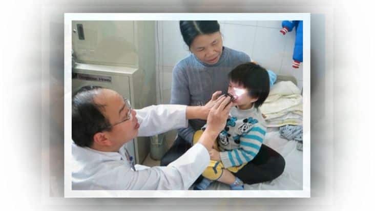 Bệnh đục thủy tinh thể ở trẻ em 3 đục thủy tinh thể ở trẻ em