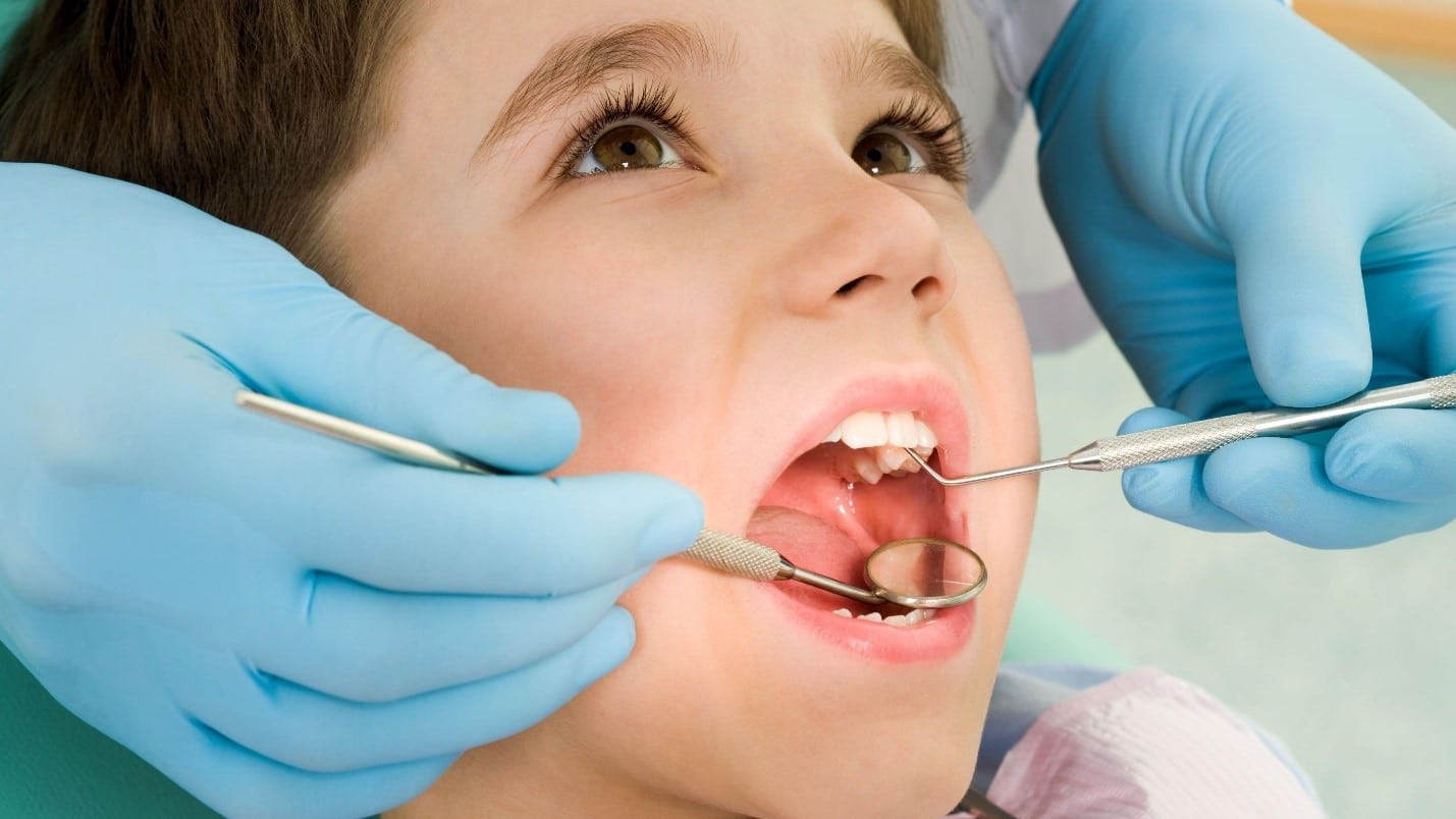 Làm thế nào khi bé bị sún răng sớm? 6 sún răng