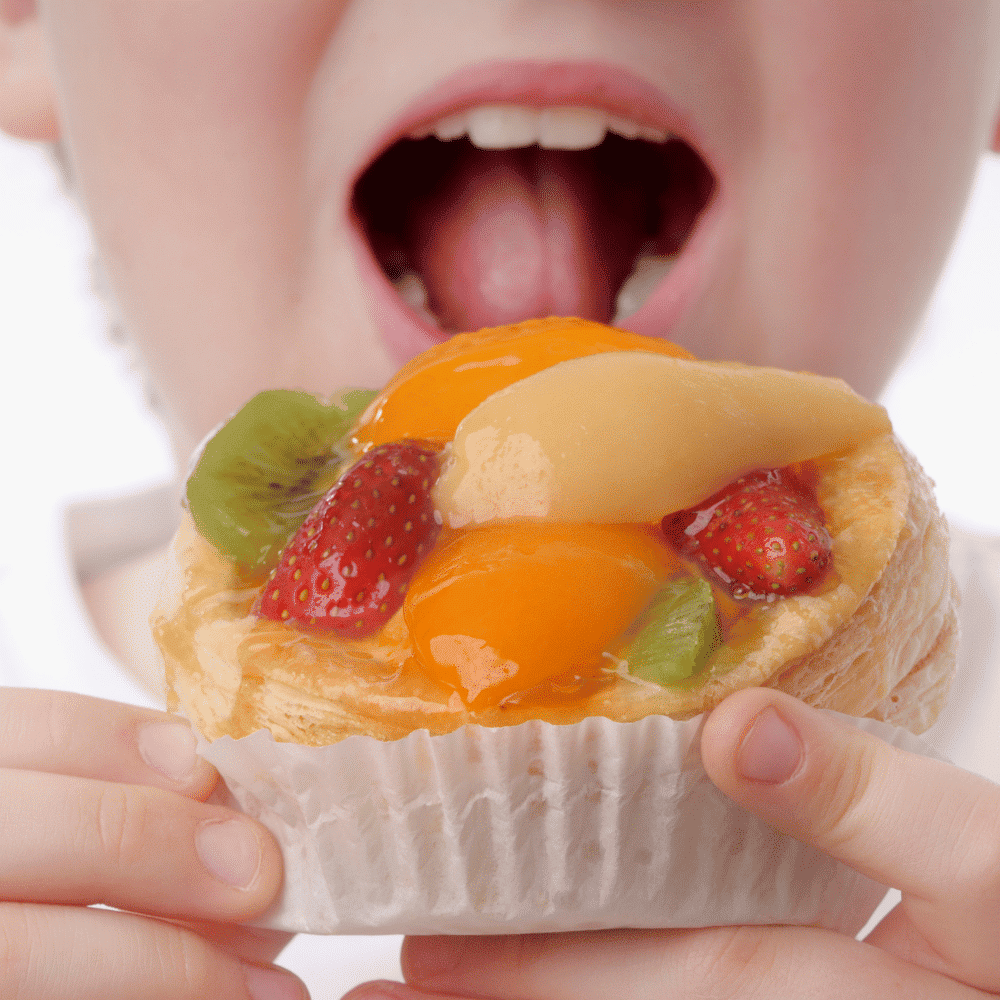 Làm thế nào khi bé bị sún răng sớm? 4 sún răng