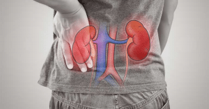 Viêm thận bể thận cấp