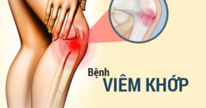 bệnh viêm khớp