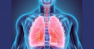 bệnh xơ phổi