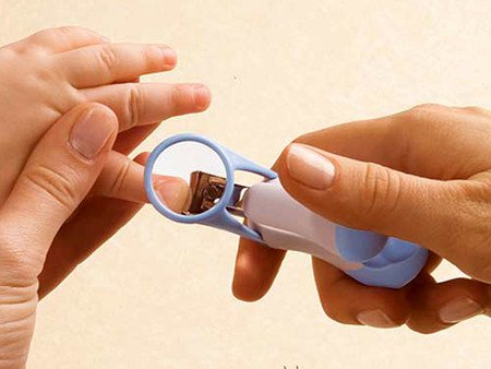 Bệnh chốc lây ngoài da ở trẻ nhỏ 3 bệnh chốc lây