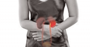 viêm cầu thận cấp