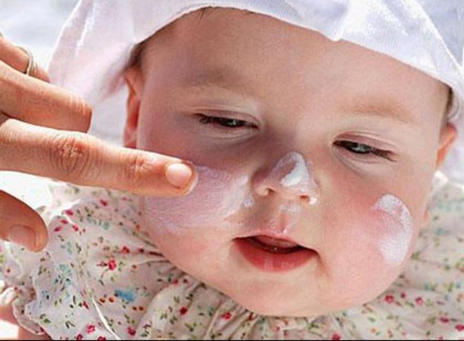 Vì sao trẻ nhỏ bị viêm da tiết bã? 3 viêm da tiết da