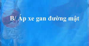 p xe gan đường mật