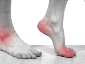 Bệnh Gout - Nguyên Nhân và Triệu Chứng 2 Đau đớn do bệnh Gout