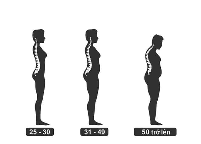 Loãng Xương - Nguyên Nhân và Triệu Chứng 2 Nguy cơ loãng xương tăng dần theo thời gian