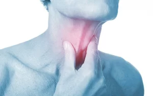 ung thu vom hong image