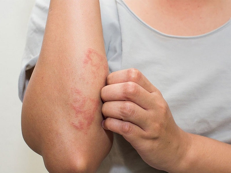 Nhận Biết Khi Cơ Thể Bị Nhiễm Ký Sinh Trùng 2 Ký sinh trùng sán máng