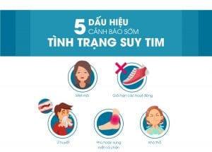 Suy Tim - Nguyên Nhân Và Triệu Chứng 2 Các dấu hiệu thường thấy của suy tim