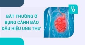 anh bia bat thuong o bung dau hieu ung thu
