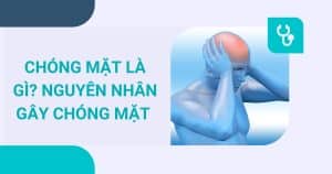 anh bia chong mat la gi