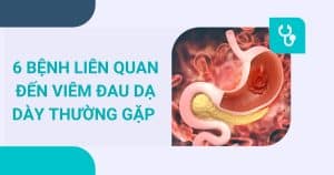 anh bia viem loet da day